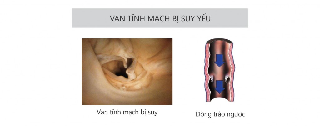 SUY TINH MACH LA GI_4